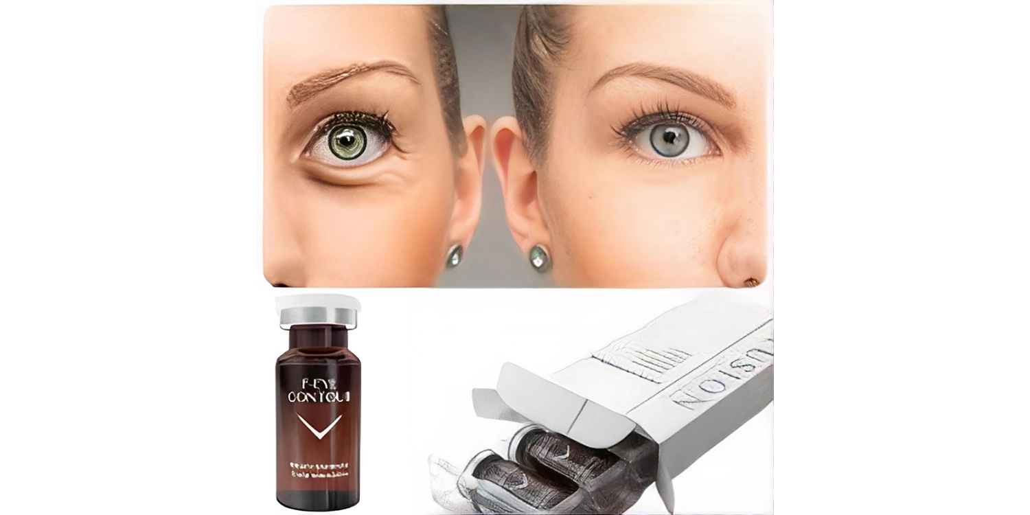 قیمت مزو زیر چشم فیوژن