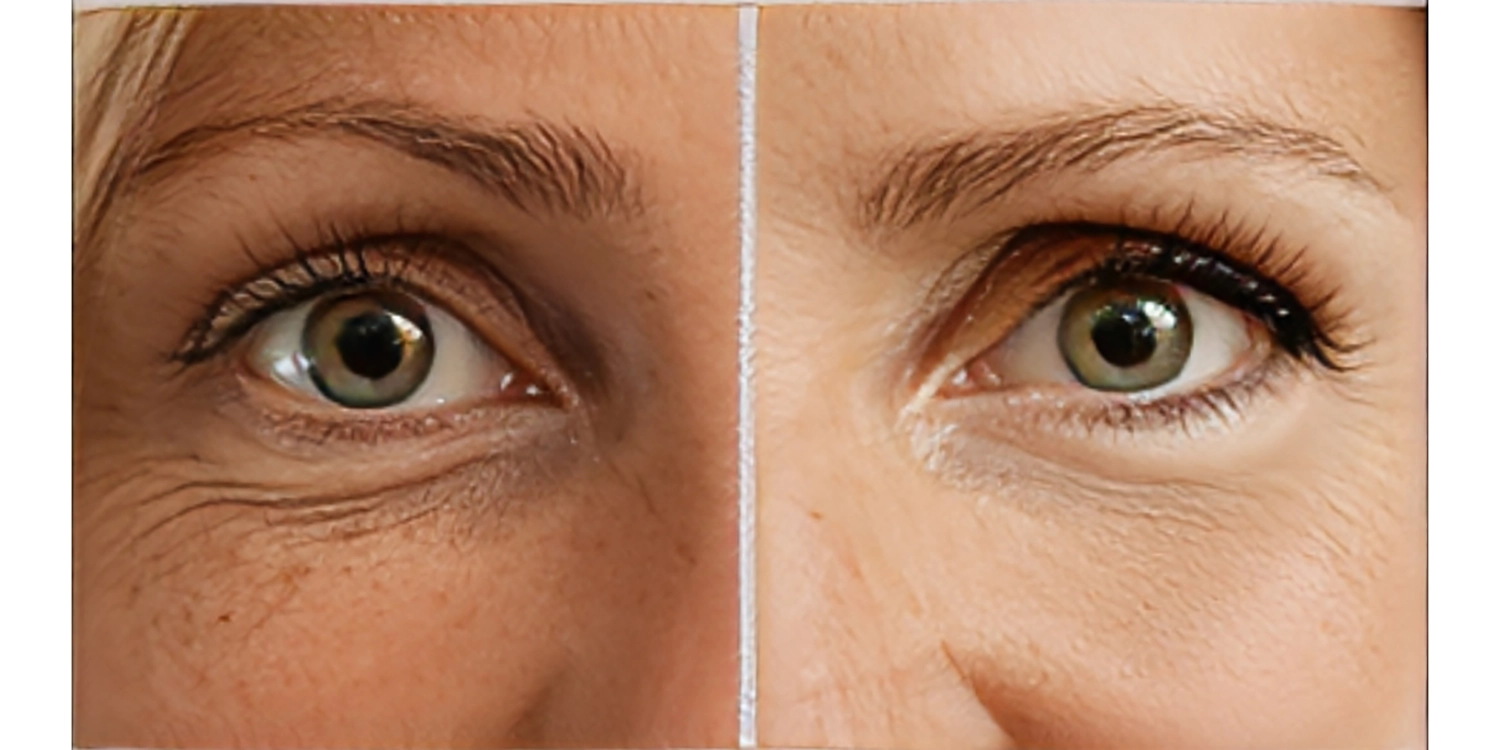 تحلیل مولکولی عملکرد کوکتلهای ضد پیری کوکتل فیوژن