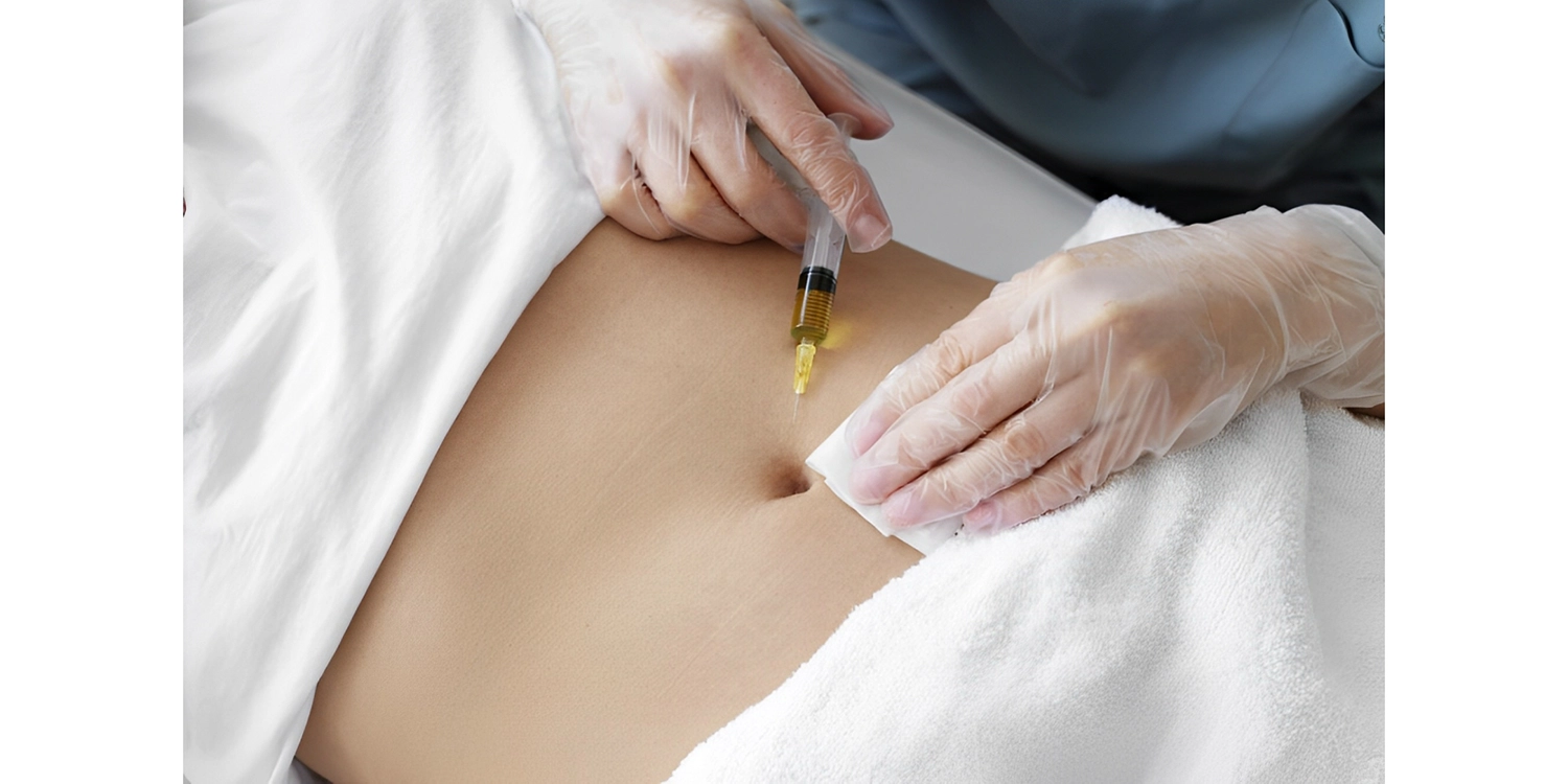 راهنمای جامع تزریق کوکتل های مزوتراپی فیوژن : تکنیک های حرفه ای